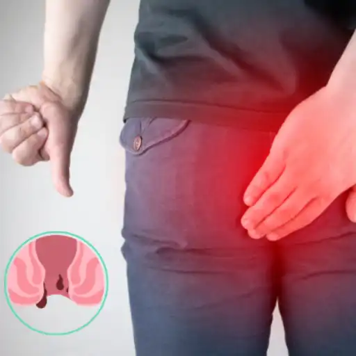 Best Anal Fissure Surgery Doctors In Kanpur