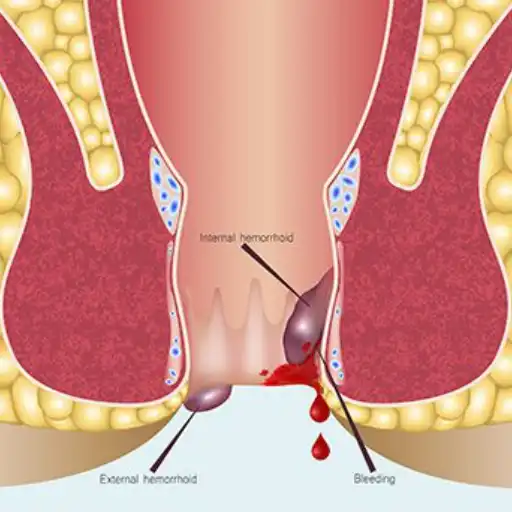 Best proctologist in Kanpur