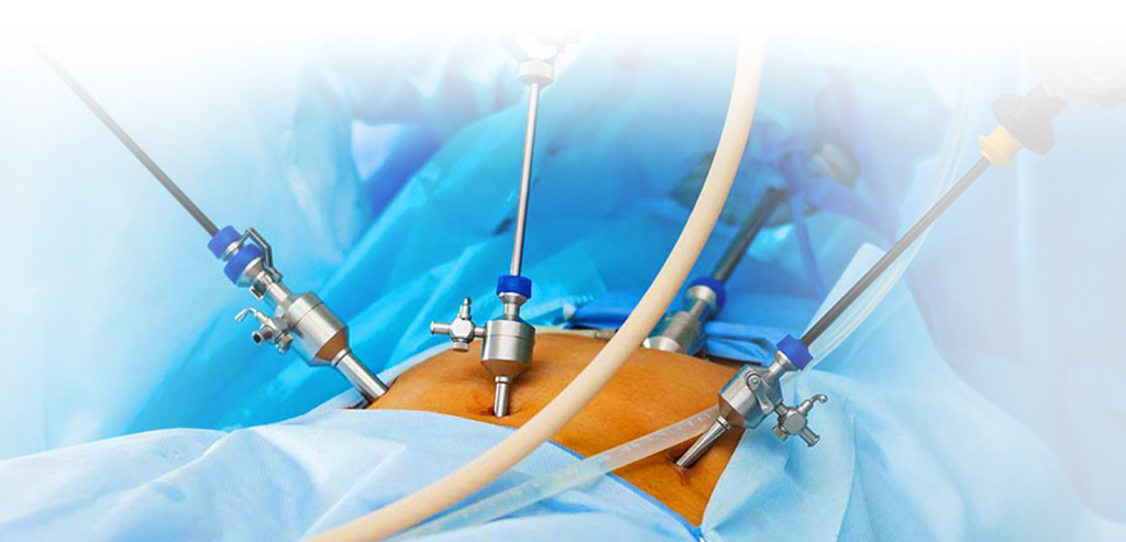 Best laparoscopic hernia surgery in Kanpur